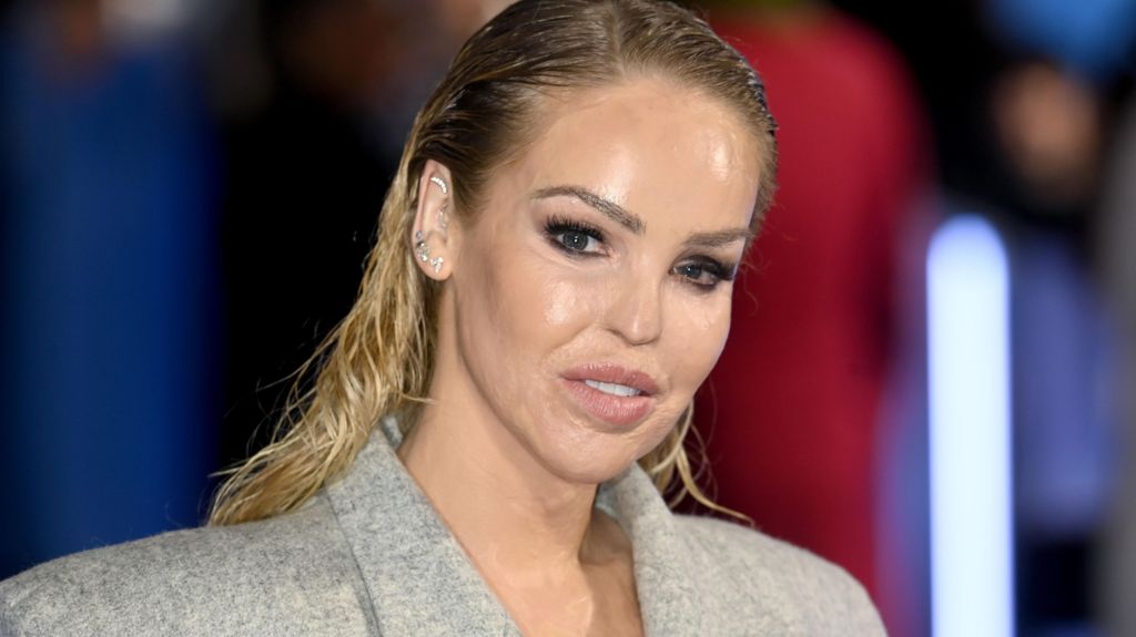 Katie Piper gets ‘artificial eye’ after acid attack